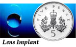 Implant